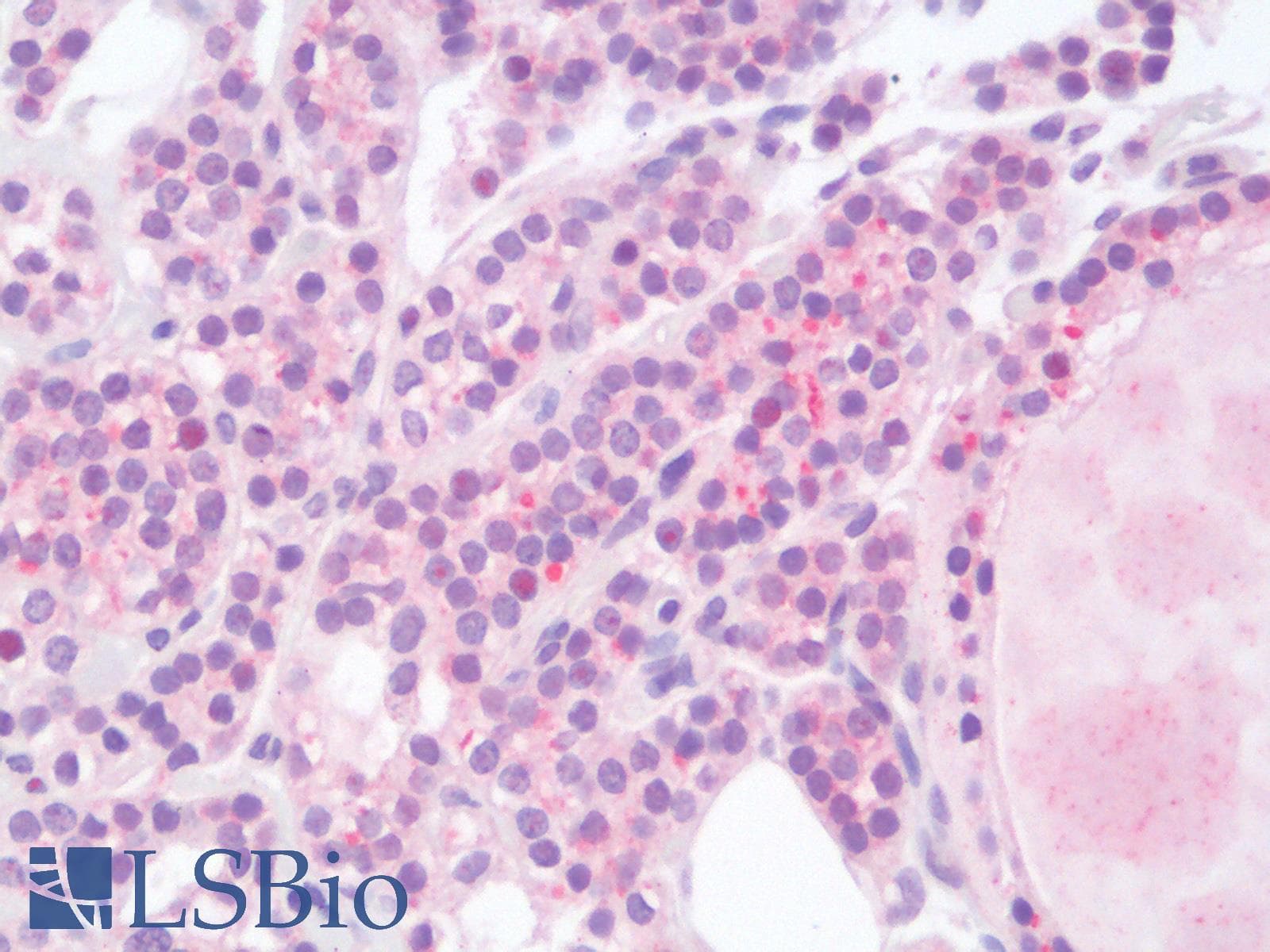 PathPlus™ Polyclonal Rabbit anti-Human HPSE / Heparanase Antibody (IHC)
