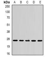 Polyclonal Rabbit anti-Human SPR Antibody (WB)