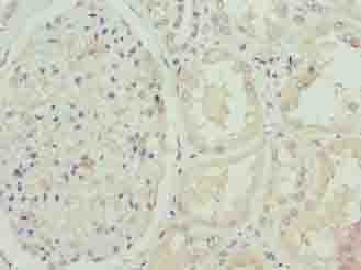 FBXO25 Antibody