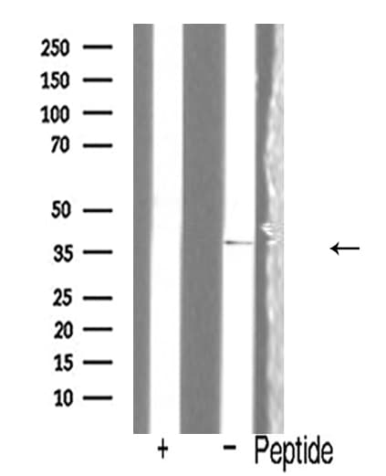 IL12B / IL12 p40 Antibody