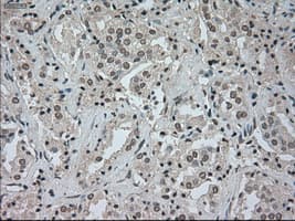 CTAG1B / NY-ESO-1 Antibody (clone OTI2B6)
