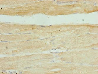 SERTAD1 / TRIP-Br1 / SEI-1 Antibody