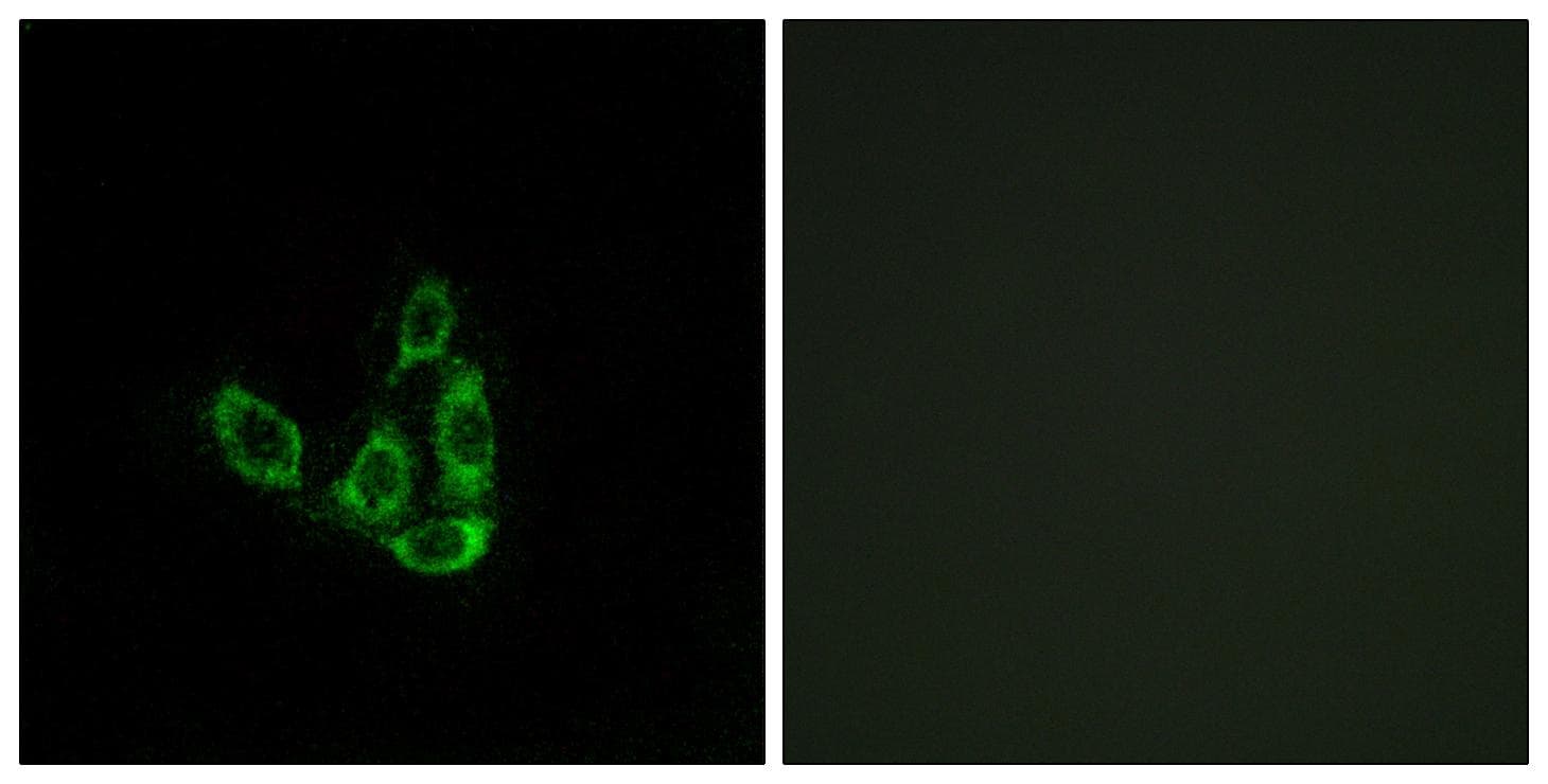 Polyclonal Rabbit anti-Human GCNT3 Antibody (IHC, IF)