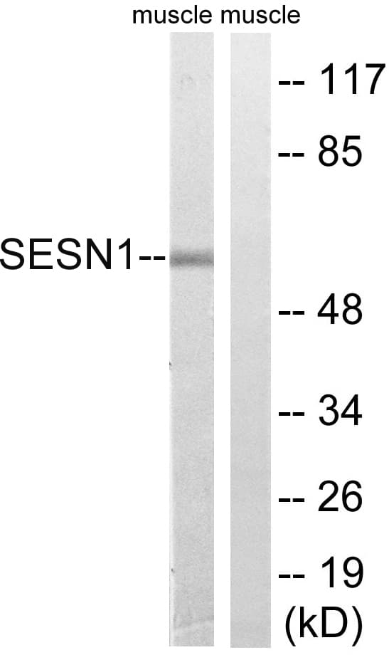 PA26 / SESN1 Antibody (aa271-320)