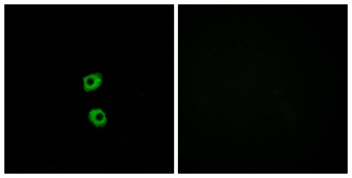 FZD7 / Frizzled 7 Antibody (aa45-94)