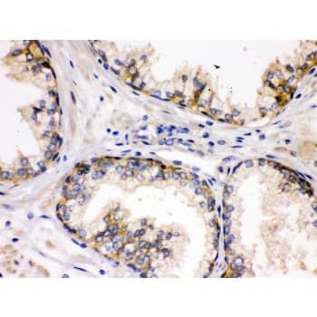 Polyclonal Rabbit anti-Human DLG1 / SAP97 Antibody (aa1-165, IHC, WB)