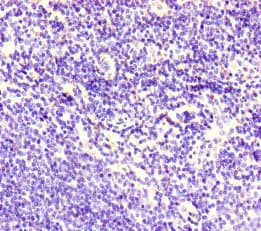 Corneodesmosin / CDSN Antibody