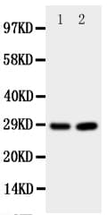 PRNP / PrP / Prion Antibody (aa143-159)