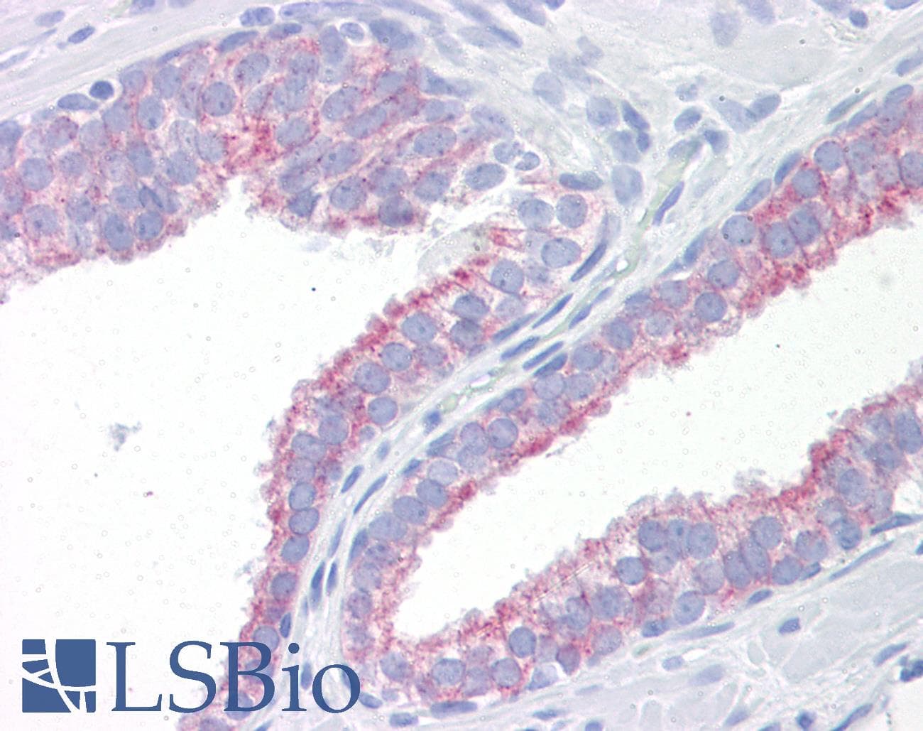 IHC-plus™ KRT18 / CK18 / Cytokeratin 18 Antibody (clone DE-K18)