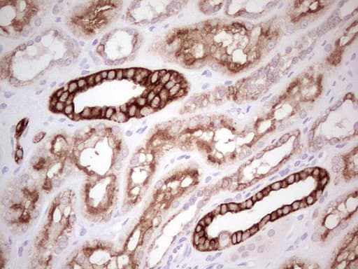 ABCB1 / MDR1 / P Glycoprotein Antibody (aa995-1280, clone OTI10H3)