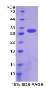 Human PSMD9 / 26S Proteasome Protein (Recombinant His-T7)