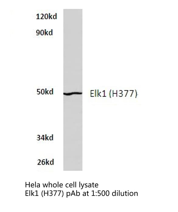 ELK1 Antibody (His377)