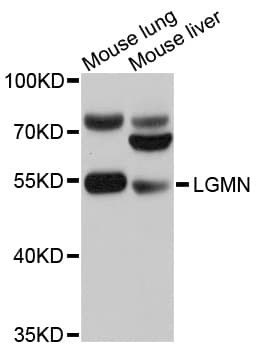 IHC-plus™ Polyclonal Rabbit anti-Human LGMN / Legumain Antibody (IHC, WB)