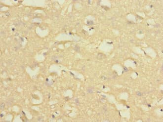Polyclonal Rabbit anti-Human NISCH Antibody (IHC)