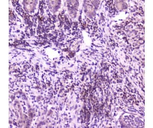 PLCG2 / PLC Gamma 2 Antibody