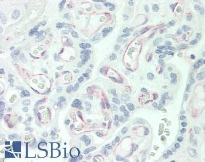 IHC-plus™ NOVA1 Antibody (C-Terminus)