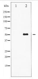 Vimentin Antibody
