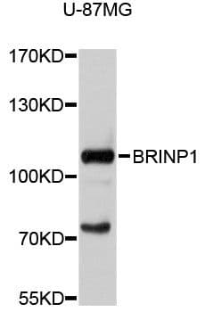 BRINP1 / DBC1 Antibody