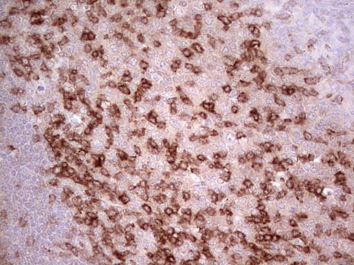 PDCD1 / CD279 / PD-1 Antibody (clone OTI8H8)