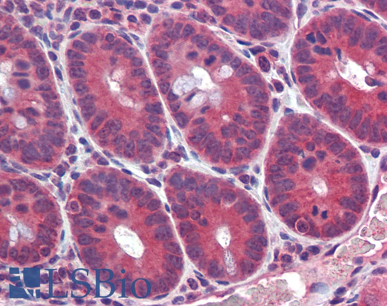 IHC-plus™ Polyclonal Rabbit anti-Human CBLN1 / Cerebellin 1 Antibody (IHC, WB)