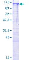 Human MAP3K14 Protein (Recombinant GST)