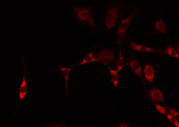 Polyclonal Rabbit anti-Human B4GALNT1 / GM2/GD2 Synthase Antibody (aa302-325, IF, WB)