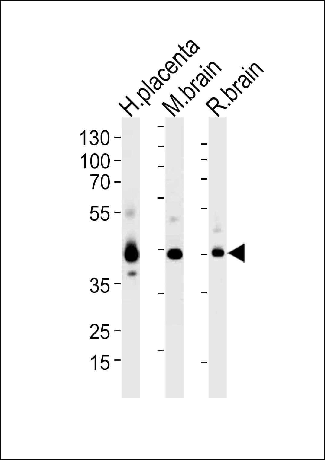 JAM3 Antibody (aa261-295)