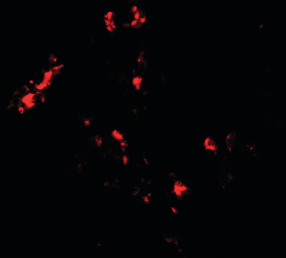 IHC-plus™ CMPK2 Antibody