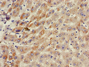 ACAD11 Antibody