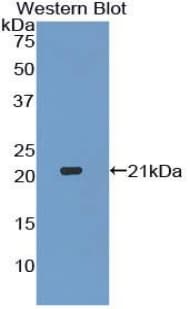 APOB / Apolipoprotein B Antibody (aa3329-3494, PE)