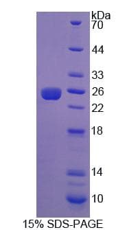 Rat IGF1R / IGF1 Receptor Protein (Recombinant His, N-Terminal)