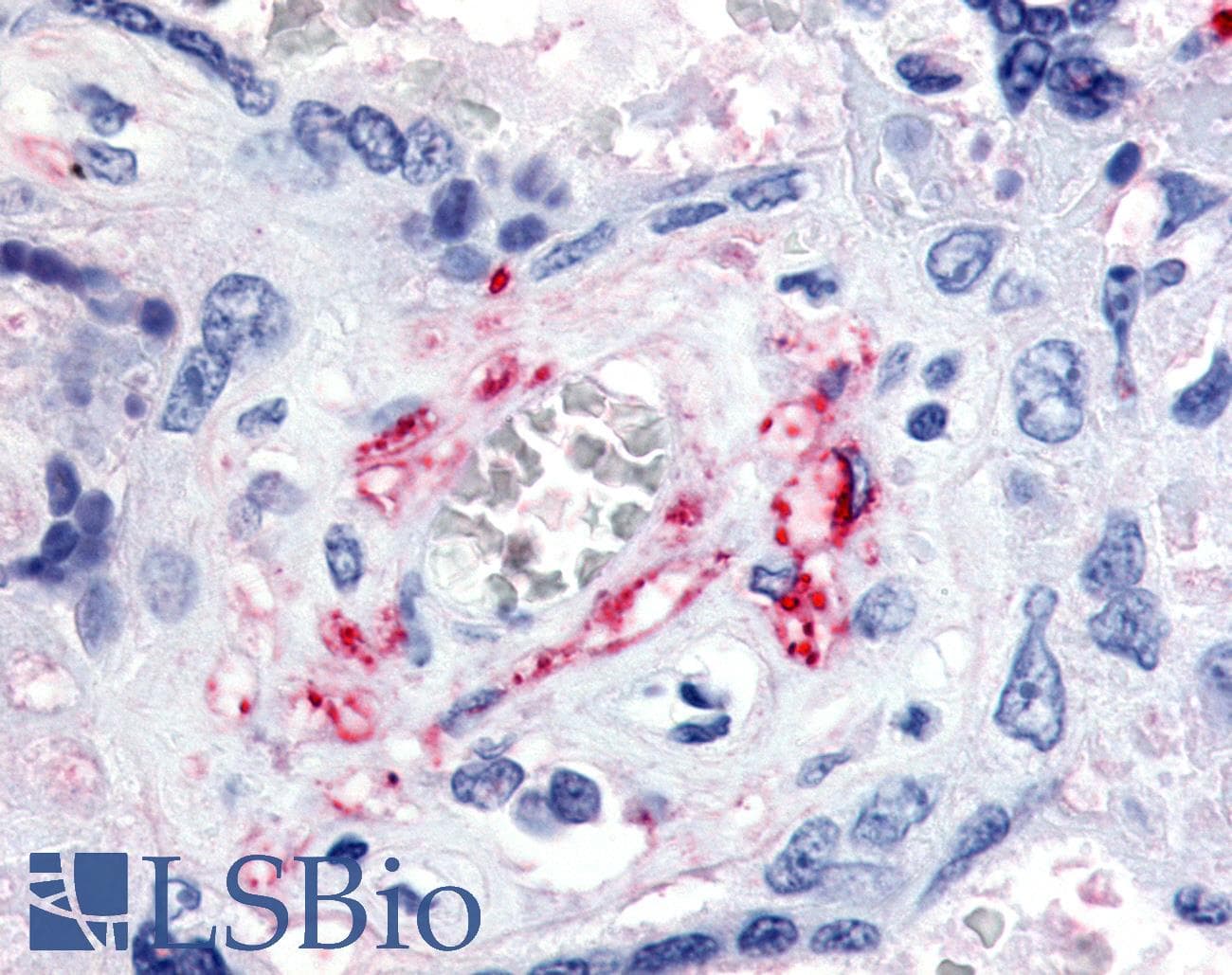 IHC-plus™ Polyclonal Rabbit anti-Human FLT1 / VEGFR1 Antibody (N-Terminus, IHC)