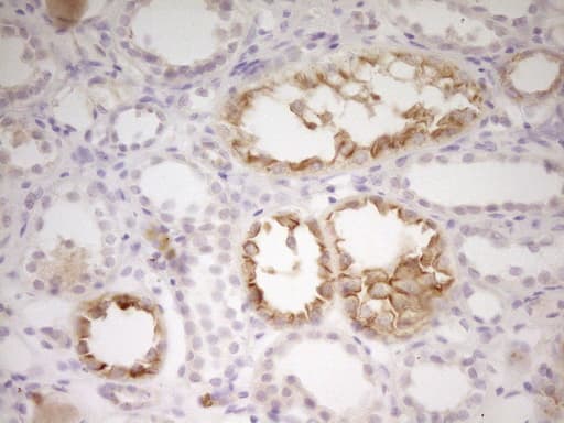 ADM / Adrenomedullin Antibody (aa22-146, clone OTI8A1)