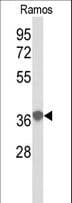 EEF1D Antibody (aa1-30)