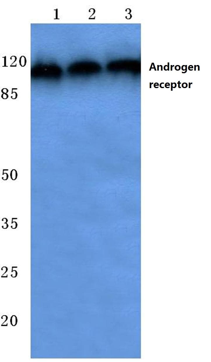 IHC-plus™ Polyclonal Rabbit anti-Human AR / Androgen Receptor Antibody (aa611-660, IHC, WB)