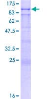 Human BAZ2B Protein (Recombinant GST)