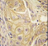 Polyclonal Rabbit anti-Human EPHB2 / EPH Receptor B2 Antibody (IHC, WB)