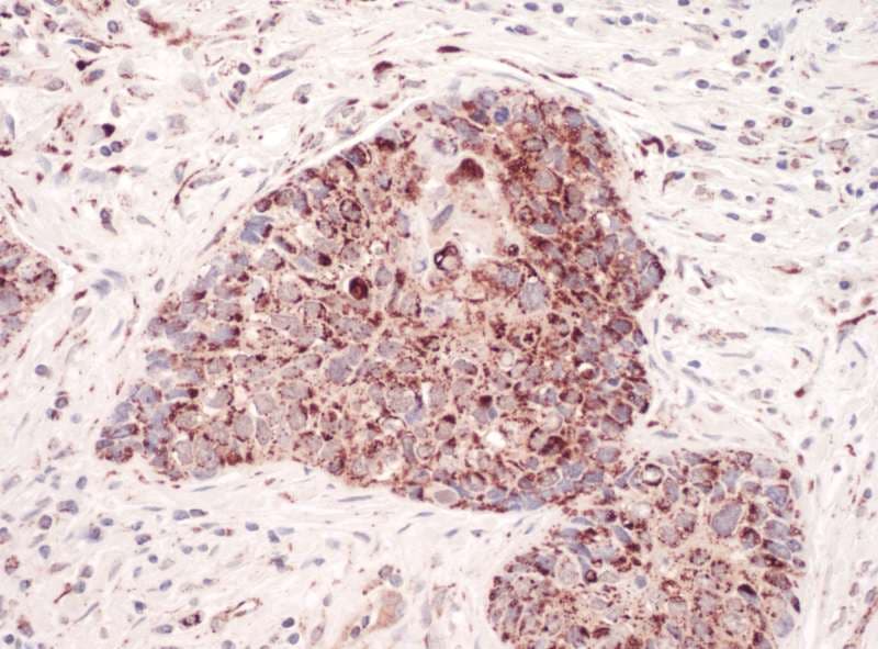 Polyclonal Rabbit anti-Human GC1qR / C1QBP Antibody (aa50-100, IHC, WB)