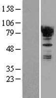 Human EWSR1 / EWS Protein (Over-Expression Lysate Myc-DDK (Flag))
