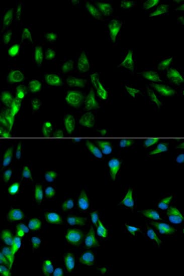 PathPlus™ Polyclonal Rabbit anti-Human RASSF1 / RASSF1A Antibody (IHC, IF, WB)