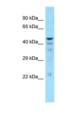 Polyclonal Rabbit anti-Human DNT / NT5C Antibody (C-Terminus, WB)