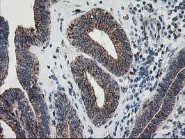 DLD / Diaphorase / E3 Antibody (clone OTI6D5)