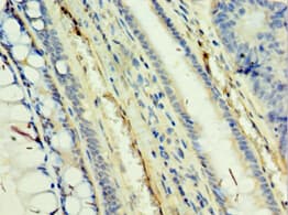 Polyclonal Rabbit anti-Human TAF5L Antibody (aa1-325, IHC)