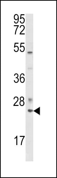 Polyclonal Rabbit anti-Human RAB7A / RAB7 Antibody (aa176-204, IHC, WB)