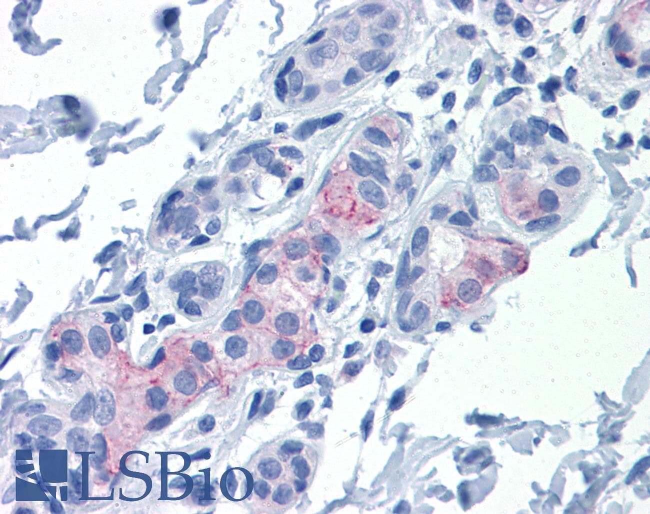 IHC-plus™ CLDN1 / Claudin 1 Antibody (clone 1C5-D9)