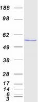Human KATNAL1 Protein (Recombinant Myc-DDK (Flag))