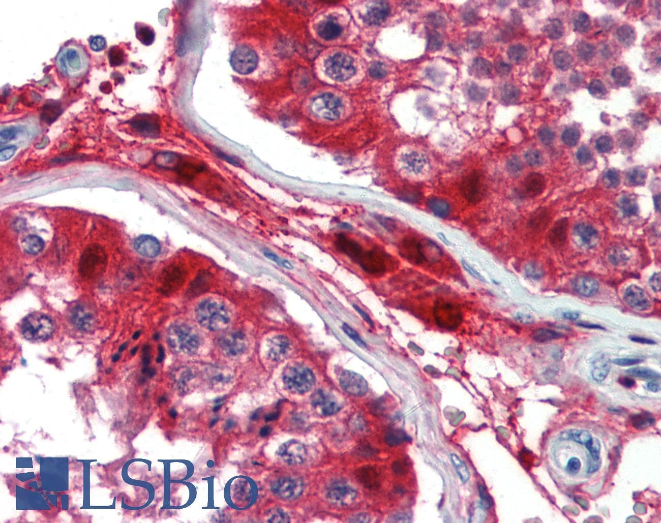 PathPlus™ GATA3 Antibody (aa36-85)