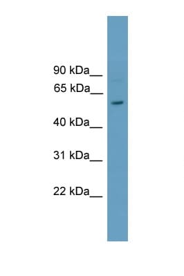 RORC / ROR Gamma Antibody (aa101-150)