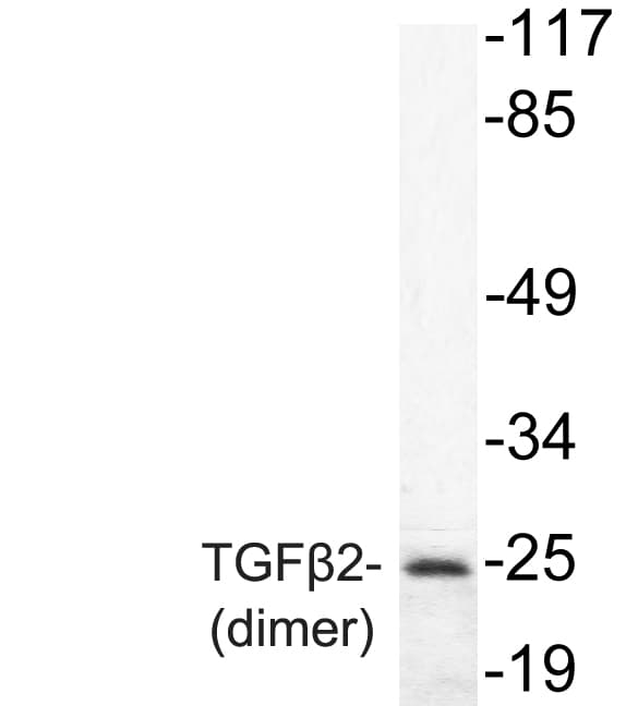TGFB2 / TGF Beta2 Antibody (Leu388)