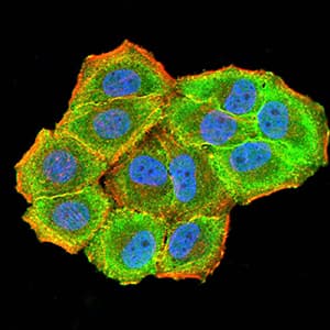 Monoclonal Mouse anti-Human CBX7 Antibody (clone 3H9D7, IHC, IF, WB)
